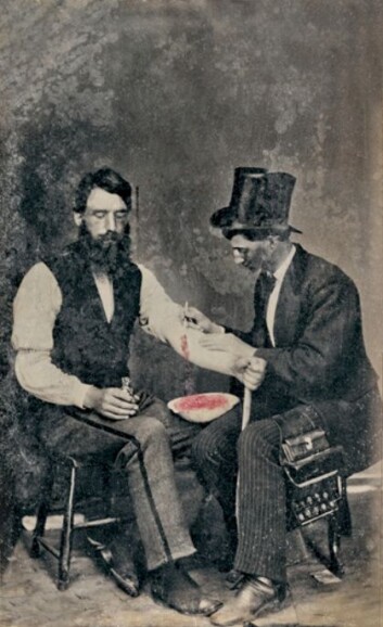Ett av tre kjente fotografier av årelating. Bildet er tatt i USA i 1860. (Foto: The Burns Archive/Wikimedia Commons) Ett av tre kjente fotografier av årelating. Bildet er tatt i USA i 1860. (Foto: The Burns Archive/Wikimedia Commons)