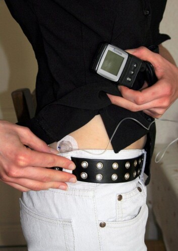 Diabetikere kan bytte sprøyter ut med en insulinpumpe. (Foto: Colourbox) Diabetikere kan bytte sprøyter ut med en insulinpumpe. (Foto: Colourbox)