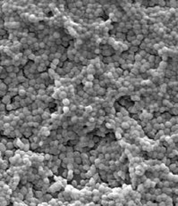 "Nærbilde av Streptococcus intermedius i biofilm." "Nærbilde av Streptococcus intermedius i biofilm."