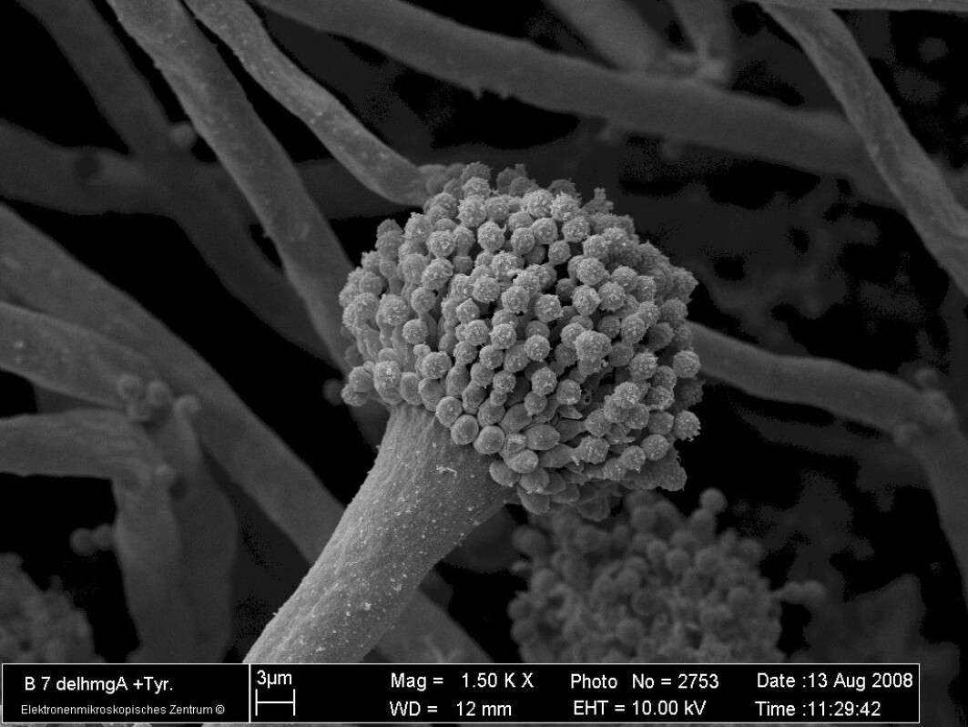 Soppen Aspergillus fumigatus' sporer. Soppen Aspergillus fumigatus' sporer.