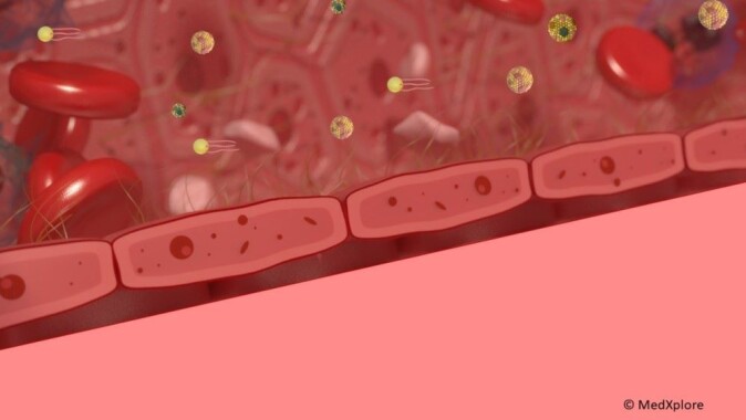 Illustration of blood vessels with lipids. The image was developed by MedXplore and is used for teching purposes. Illustration of blood vessels with lipids. The image was developed by MedXplore and is used for teching purposes.