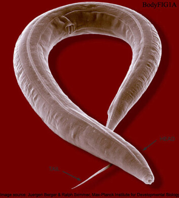 Den mikroskopiske ormen, Caenorhabditis Elegans, levde etter oppholdet i rommet lenger og ble sunnere enn artsfrendene på jorden. (Foto: Wormatlas) Den mikroskopiske ormen, Caenorhabditis Elegans, levde etter oppholdet i rommet lenger og ble sunnere enn artsfrendene på jorden. (Foto: Wormatlas)