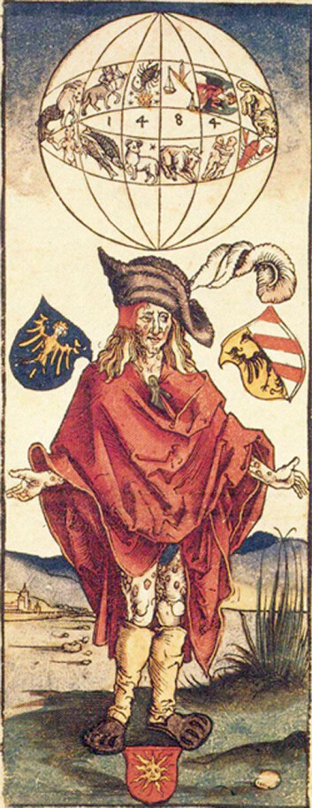 Mann med syfilis, antageligvis lagd av Albrecht Dürer (1496). Årstallet 1484 refererer ikke til datoen for verket, men kanskje til en uheldig stjernestilling som kunne ha skylda for sykdommen. (Foto: PhilippN/Wikimedia Commons) Mann med syfilis, antageligvis lagd av Albrecht Dürer (1496). Årstallet 1484 refererer ikke til datoen for verket, men kanskje til en uheldig stjernestilling som kunne ha skylda for sykdommen. (Foto: PhilippN/Wikimedia Commons)