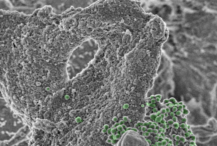Sveipelektronmikroskopbilde av bakterien Mycoplasma genitalium (farget grønne) som angriper en celle fra vagina. (Foto: (Bilde: Rajesh K. Grover og Richard B. Pyles)) Sveipelektronmikroskopbilde av bakterien Mycoplasma genitalium (farget grønne) som angriper en celle fra vagina. (Foto: (Bilde: Rajesh K. Grover og Richard B. Pyles))