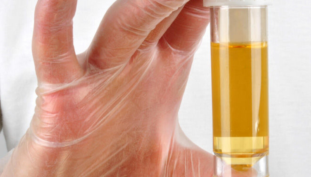 Hvorfor er urinen gul?
