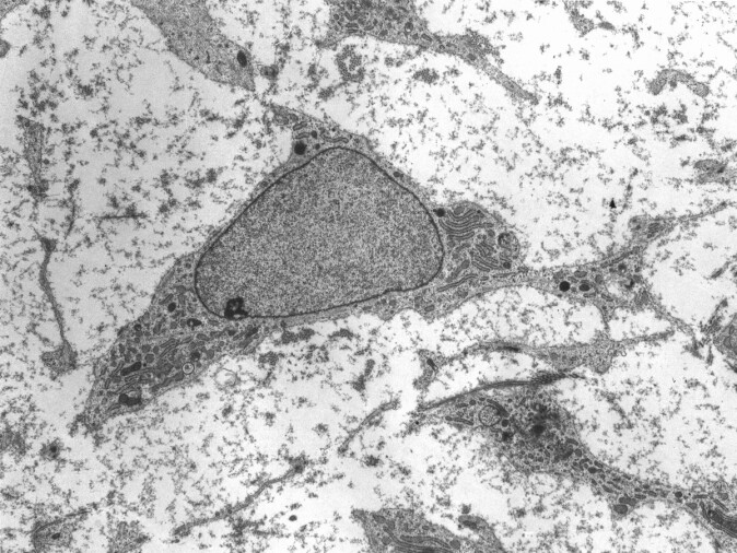 Transmission electron micrograph of a mesenchymal stem cell displaying typical ultrastructural characteristics. Transmission electron micrograph of a mesenchymal stem cell displaying typical ultrastructural characteristics.