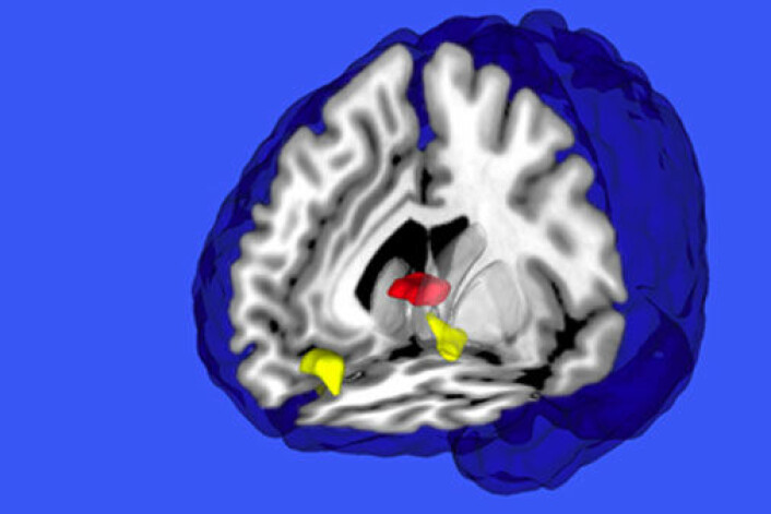 De røde områdene viser områdene i septum og cuadate, hvor hjernen signaliserer tilfredsstillelse. De gule områdene er ventral striatum og ventral medial prefrontalkorteks, områder hvor hjernen signaliserer tilfredsstillelse av individuell læring. (Illustrasjon: Guido Biele)