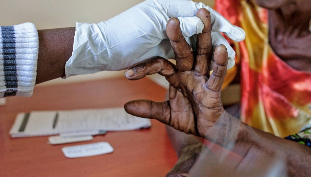 En eldre kvinne testes for malaria øst i Uganda. En eldre kvinne testes for malaria øst i Uganda.