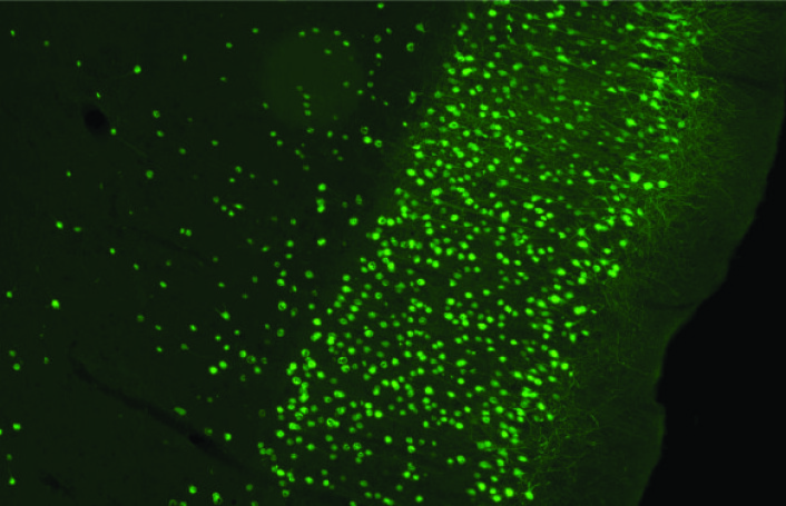 Utsnitt av rottehjerne. Bilder viser celler i entorhinal cortex som er infisert av virus injisert i hippocampus. Viruset bærer genet for et grønt fluorescerende fargestoff som gjør det mulig å se de infiserte cellene. (Foto: Kavliinstituttet) Utsnitt av rottehjerne. Bilder viser celler i entorhinal cortex som er infisert av virus injisert i hippocampus. Viruset bærer genet for et grønt fluorescerende fargestoff som gjør det mulig å se de infiserte cellene. (Foto: Kavliinstituttet)