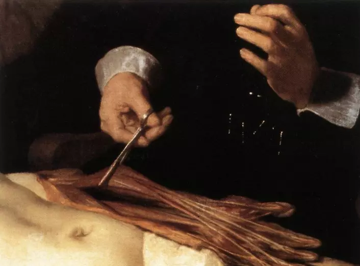 Kva er det med denne underarmen som gjorde at den vart eit mysterium? Og gjorde Dr. Tulp og Rembrandt ein anatomisk feil? (Foto: Wikimedia commons)