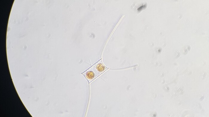 En ensom alge, Chaetoceros decipiens, som med sine to tydelige sporer viser at våren ikke er en realitet ved 82 grader nord. Hvor mye lengre må de vente, tro? En ensom alge, Chaetoceros decipiens, som med sine to tydelige sporer viser at våren ikke er en realitet ved 82 grader nord. Hvor mye lengre må de vente, tro?
