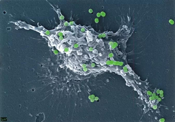 Slik ser det ut når ei immuncelle – ei dendrittisk celle – bind Methylococcus-bakteriar til overflata. Tor Erling Lea har teke biletet med sveipeelektronmikroskopi, og grønfargen er lagt på etterpå.