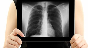 Biomarkører bedrer fremtidsutsiktene for lungekreft