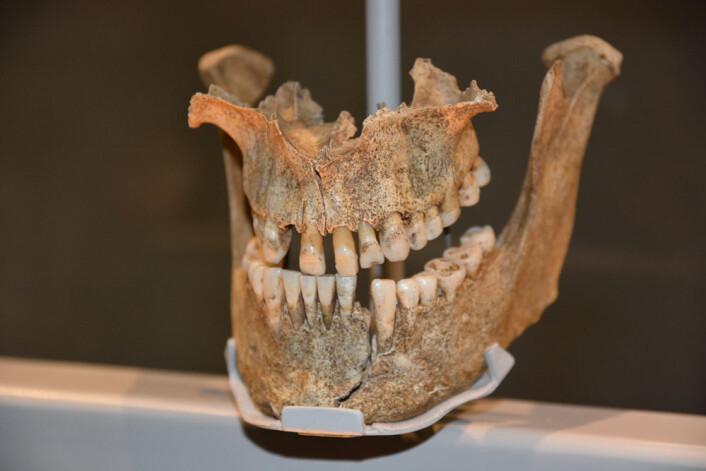 Denne vikingen filte fortennene sine for å skape et fryktinngytende inntrykk, tror fagfolkene bak utstillingen. Kanskje han også farget dem for å skremme litt ekstra. Dorset i England, 975-1025. (Foto: Ida Kvittingen) Denne vikingen filte fortennene sine for å skape et fryktinngytende inntrykk, tror fagfolkene bak utstillingen. Kanskje han også farget dem for å skremme litt ekstra. Dorset i England, 975-1025. (Foto: Ida Kvittingen)