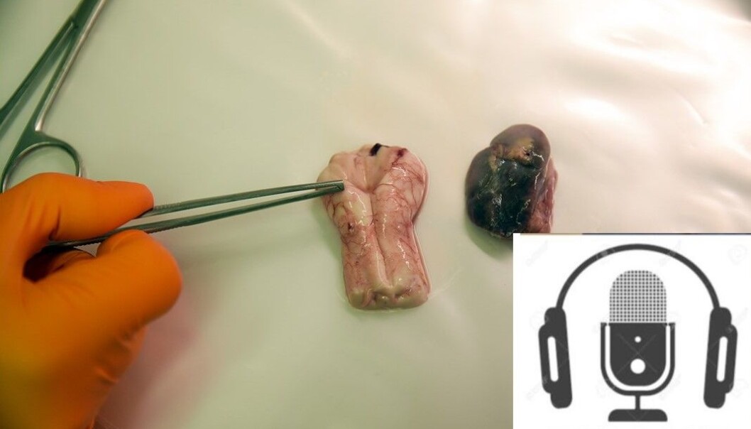 På Veterinærinstituttet mottar de alle prøver fra hjortedyr som skal analyseres for prionsykdommer. På Veterinærinstituttet mottar de alle prøver fra hjortedyr som skal analyseres for prionsykdommer.