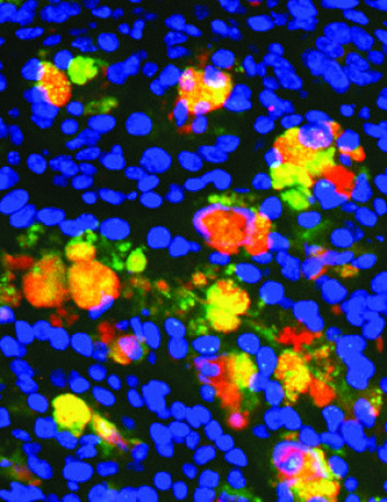 Bildet viser en musetarm hvor proteinene (de røde flekkene) som bygger opp det beskyttende slimlaget i tarmen ikke virker som de skal. (Foto: Washington University School of Medicine) Bildet viser en musetarm hvor proteinene (de røde flekkene) som bygger opp det beskyttende slimlaget i tarmen ikke virker som de skal. (Foto: Washington University School of Medicine)