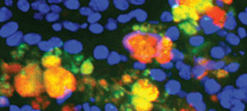Bildet viser en musetarm hvor proteinene (de røde flekkene) som bygger opp det beskyttende slimlaget i tarmen ikke virker som de skal. Washington University School of Medicine