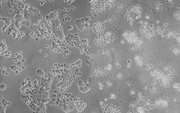 Cellene ser friske ut etter tre dager i hypoksi-inkubatoren (til venstre). Etter fem uker har massiv celledød inntrådt (til høyre). (Foto: Metoxia-prosjektet)