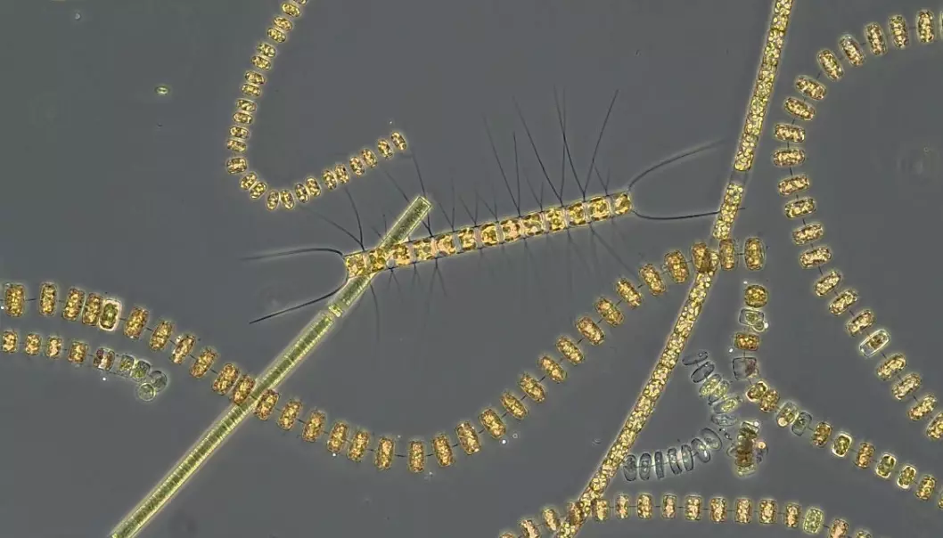Ulike kjedeformende kiselarter som er typiske for vårblomstringen under mikroskopet.