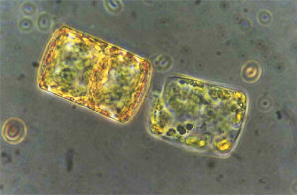 To kiselalger som har hektet seg sammen, sett gjennom mikroskop. Disse tilhører arten Thalassiosira bioculate. (Foto: Else Nøst Hegseth)