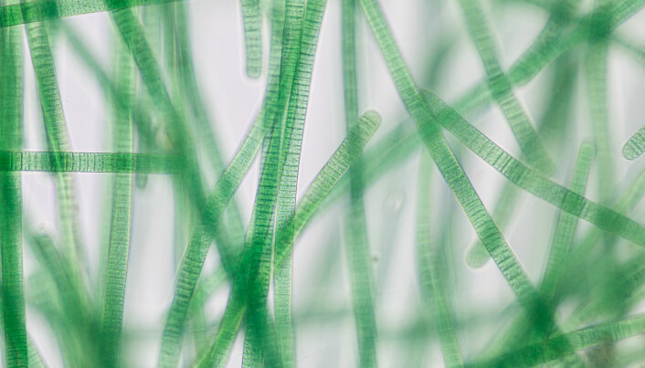 Blågrønne bakterier kalles også cyanobakterier. Her ser du noen av dem under mikroskopet.