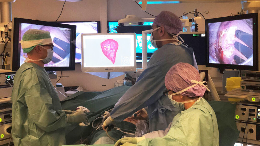 Surgeon Davit Aghayan (back right) participated in a study with almost 300 patients at the Oslo University Hospital, Rikshospitalet, where patients with tumors in the liver were operated on using two different techniques. To the left is Åsmund Fretland at the intervention centre. Surgeon Davit Aghayan (back right) participated in a study with almost 300 patients at the Oslo University Hospital, Rikshospitalet, where patients with tumors in the liver were operated on using two different techniques. To the left is Åsmund Fretland at the intervention centre.