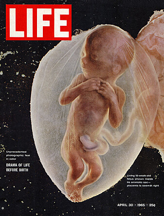 Bildet av Romfareren på forsiden av Life Magazine endret abortdebatten i Norge og resten av verden. Bildet av Romfareren på forsiden av Life Magazine endret abortdebatten i Norge og resten av verden.