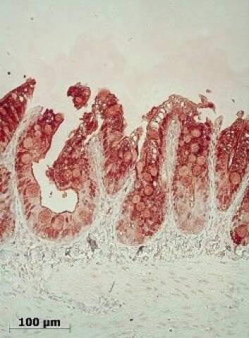 Fabp2 immunohistokjemi. Rødfargen illustrerer Fabp2 i blindsekkene hos atlanyisk laks. (Foto: Fredrik Venold) Fabp2 immunohistokjemi. Rødfargen illustrerer Fabp2 i blindsekkene hos atlanyisk laks. (Foto: Fredrik Venold)