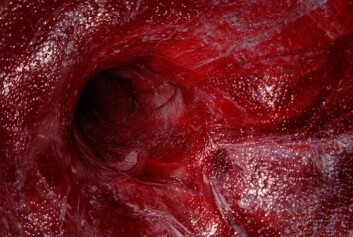 Å hindre blodkarnydannelse til kreftsvulsten kan bli en effektiv individualisert kreftbehandling. (Foto: (Illustrasjon: www.colourbox.no)) Å hindre blodkarnydannelse til kreftsvulsten kan bli en effektiv individualisert kreftbehandling. (Foto: (Illustrasjon: www.colourbox.no))