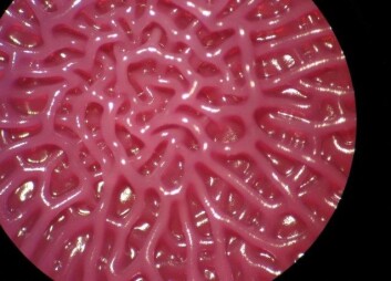 Bilde av salmonella-biofilm tatt gjennom lupe. Den tredimensjonale strukturen bakteriesamfunnet bygger i en biofilm er ikke tilfeldig. "Arkitekturen" har til hensikt å lett frakte inn næringsstoffer og frakte ut avfallstoffer. (Foto: Nesse og Vestby) Bilde av salmonella-biofilm tatt gjennom lupe. Den tredimensjonale strukturen bakteriesamfunnet bygger i en biofilm er ikke tilfeldig. "Arkitekturen" har til hensikt å lett frakte inn næringsstoffer og frakte ut avfallstoffer. (Foto: Nesse og Vestby)