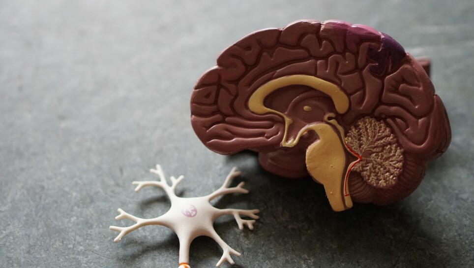 I hjernen til pasienter med Parkinsons dør cellene der produksjonen av dopamin skjer.