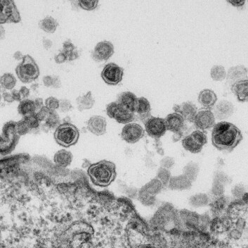 Sterkt forstørret bilde av det humane gammaretroviruset xenotropic murine leukemia virus-related virus (XMRV), i blodet til en pasient med kronisk utmattelsessyndrom. (Foto: Whittemore Peterson Institute) Sterkt forstørret bilde av det humane gammaretroviruset xenotropic murine leukemia virus-related virus (XMRV), i blodet til en pasient med kronisk utmattelsessyndrom. (Foto: Whittemore Peterson Institute)