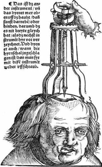 På 1700 og 1800-tallet florerte det med behandlinger som vi i dag vil kalle alternative. Noen av dem var virkningsløse, noe man beviste ved blindforsøk, men hadde likevel en effekt via pasientens tanker. (Illustrasjon: Hans Wechtlin) På 1700 og 1800-tallet florerte det med behandlinger som vi i dag vil kalle alternative. Noen av dem var virkningsløse, noe man beviste ved blindforsøk, men hadde likevel en effekt via pasientens tanker. (Illustrasjon: Hans Wechtlin)