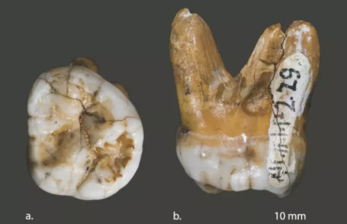 Tann funnet i Denisova-hulen i Sibir. Forskere mener den tilhører en ny og inntil ganske nylig ukjent menneskeart som levde samtidig med neandertalerne - men var markert forskjellig fra dem. Bildet viser tannen sett fra to vinkler (a og b). (Foto: David Reich et al, Nature)