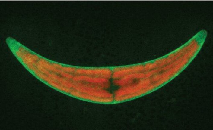 Closterium moniliferum kan ta opp strontium fra vann, men tar ikke opp kalsium. (Foto: Wiley-VCH) Closterium moniliferum kan ta opp strontium fra vann, men tar ikke opp kalsium. (Foto: Wiley-VCH)