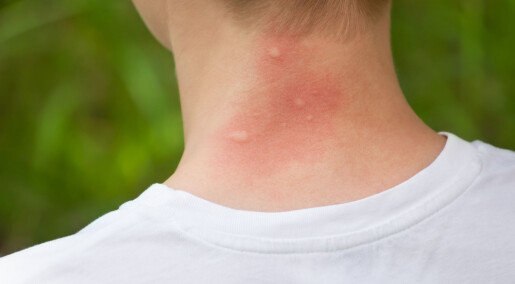 Kan du bli immun mot myggstikk?