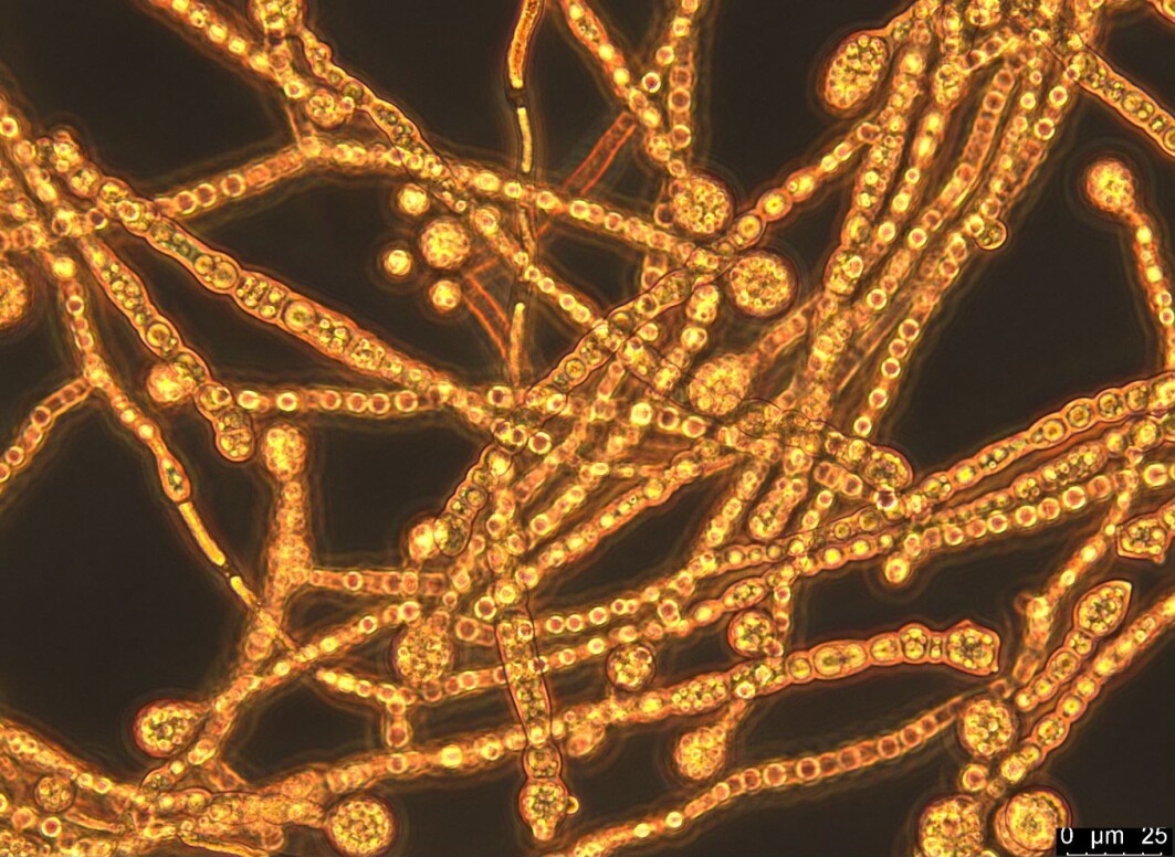 Mucor circinelloides hyphae containing lipid bodies. Mucor circinelloides hyphae containing lipid bodies.
