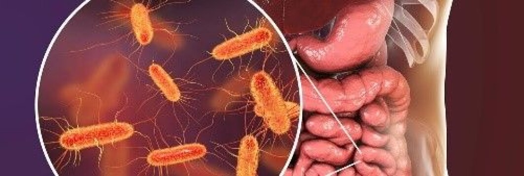 Rask og skreddersydd diagnostikk kan gi bedre forutsetninger i fremtiden med tanke på å minske antall pasienter med alvorlig forløp og død. Rask og skreddersydd diagnostikk kan gi bedre forutsetninger i fremtiden med tanke på å minske antall pasienter med alvorlig forløp og død.