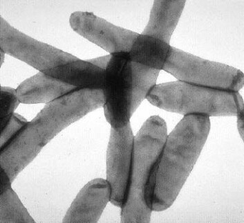 "Legionella-bakterier." "Legionella-bakterier."