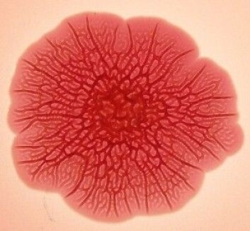 Biofilm av Salmonella på agar Biofilm av Salmonella på agar