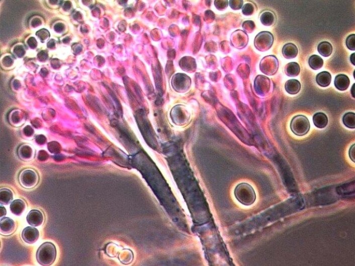 Men vakre er de... Nærbilde av muggsoppen Penicillium roqueforti. (Foto: Cathrine Finne Kure) Men vakre er de... Nærbilde av muggsoppen Penicillium roqueforti. (Foto: Cathrine Finne Kure)