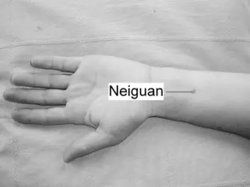 "Omtrent to fingerbredder oppover underarmen fra håndleddet finner du presspunktet (Neiguan) mot kvalme. Her kan man trykke i 20-30 minutter. Man kan også bruke et eget armbånd som gir et lett, kontinuerlig trykk på dette punktet."