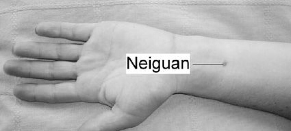 'Omtrent to fingerbredder oppover underarmen fra håndleddet finner du presspunktet (Neiguan) mot kvalme. Her kan man trykke i 20-30 minutter. Man kan også bruke et eget armbånd som gir et lett, kontinuerlig trykk på dette punktet.'