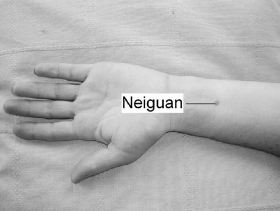 'Omtrent to fingerbredder oppover underarmen fra håndleddet finner du presspunktet (Neiguan) mot kvalme. Her kan man trykke i 20-30 minutter. Man kan også bruke et eget armbånd som gir et lett, kontinuerlig trykk på dette punktet.'