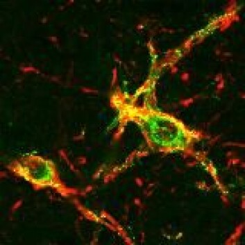 "Hannrotters utløsning kontrolleres av disse nervecellene i ryggmargen. Foto: Lique Coolen, University of Cincinnati" "Hannrotters utløsning kontrolleres av disse nervecellene i ryggmargen. Foto: Lique Coolen, University of Cincinnati"