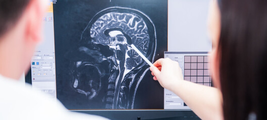 Hvorfor får mange demens etter hjerneslag?