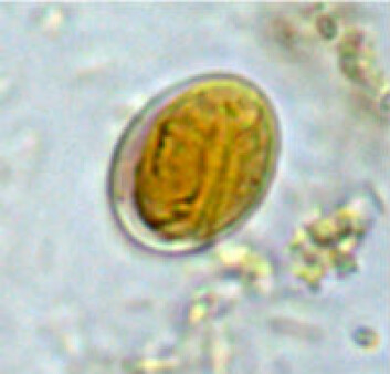 Giardia oocyste farget med Lugol. (Foto: Inger Sofie Hamnes) Giardia oocyste farget med Lugol. (Foto: Inger Sofie Hamnes)