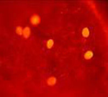 Giardia, immunofluorescens-farget. (Foto: Bjørn Gjerde) Giardia, immunofluorescens-farget. (Foto: Bjørn Gjerde)