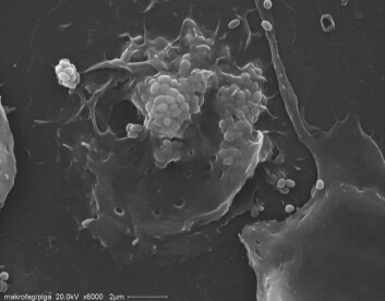Bildet viser en av fiskens «spiseceller» som har spist en mengde nanopartikler. Nanopartiklene ligger som små kolonier inne i cella. Cellas diameter er om lag 20 mikrometer. Denne «fråtsinga» leder til en målrettet immunrespons som kan være viktig i sykdomsbeskyttelsen når sykdommene er forårsaket av virus og bakterier. (Foto: Børge N. Fredriksen) Bildet viser en av fiskens «spiseceller» som har spist en mengde nanopartikler. Nanopartiklene ligger som små kolonier inne i cella. Cellas diameter er om lag 20 mikrometer. Denne «fråtsinga» leder til en målrettet immunrespons som kan være viktig i sykdomsbeskyttelsen når sykdommene er forårsaket av virus og bakterier. (Foto: Børge N. Fredriksen)