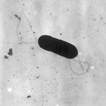 Listeria monocytogenes-bakterie. (Foto: Wikimedia Commons) Listeria monocytogenes-bakterie. (Foto: Wikimedia Commons)